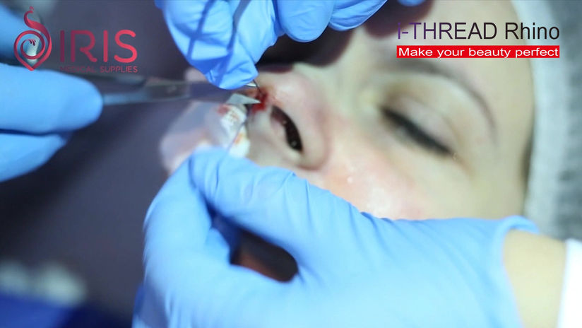 ithread rhino 2018